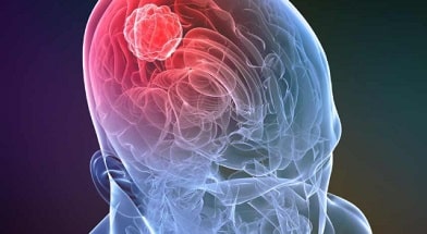 A safe method of brain tumor removal