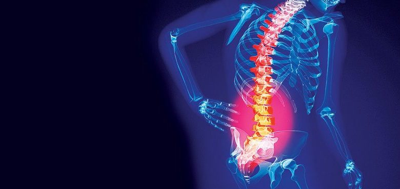 Intervertebral hernia treatment in Germany