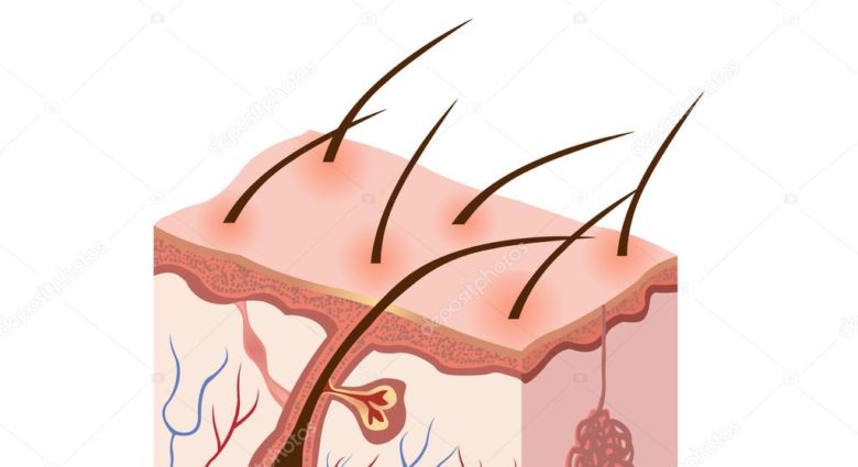 Psoriasis treatment